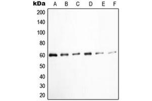 Western blot analysis of c-SRC (pY529) expression in K562 (A), HuvEc (B), Jurkat (C), COLO205 (D), HEK293T EGF-treated (E), A431 pervanadate-treated (F) whole cell lysates.