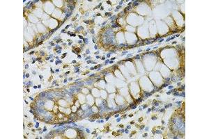 Immunohistochemistry of paraffin-embedded Human colon using GSTM2 Polyclonal Antibody at dilution of 1:100 (40x lens). (GSTM2 antibody)
