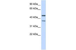 WB Suggested Anti-KCNJ4 Antibody Titration:  0. (KCNJ4 antibody  (Middle Region))