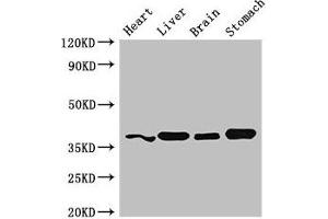 Western Blot Positive WB detected in: Mouse heart tissue, Mouse liver tissue, Mouse brain tissue, Mouse stomach tissue All lanes: YIPF3 antibody at 3 μg/mL Secondary Goat polyclonal to rabbit IgG at 1/50000 dilution Predicted band size: 39 kDa Observed band size: 39 kDa