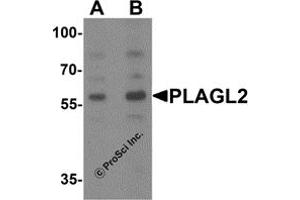 Western Blotting (WB) image for anti-Pleiomorphic Adenoma Gene-Like 2 (PLAGL2) (N-Term) antibody (ABIN1077381) (PLAGL2 antibody  (N-Term))