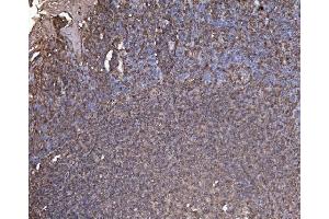 IHC analysis of RAB1B using anti-RAB1B antibody (ABIN7602809). (RAB1B antibody  (C-Term))