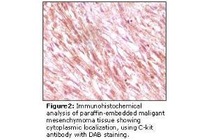 Image no. 2 for anti-Mast/stem Cell Growth Factor Receptor (KIT) antibody (ABIN232128) (KIT antibody)
