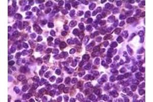 Immunohistochemistry (IHC) image for anti-B Lymphoid Tyrosine Kinase (BLK) (truncated) antibody (ABIN2464018) (BLK antibody  (truncated))