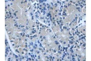 Detection of TGFbI in Human Stomach Tissue using Polyclonal Antibody to Transforming Growth Factor Beta Induced Protein (TGFbI) (TGFBI antibody  (AA 423-632))