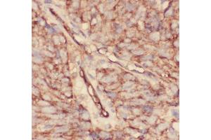 Anti-CD34 Picoband antibody,  IHC(P): Human Lung Cancer Tissue