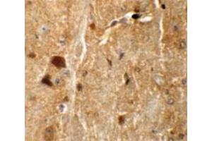 Immunohistochemical staining of mouse brain cells with TMEM192 polyclonal antibody  at 5 ug/mL.