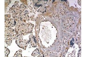 Immunohistochemistry (IHC) image for anti-Tumor Necrosis Factor Receptor Superfamily, Member 8 (TNFRSF8) (AA 19-379) antibody (ABIN1983081)