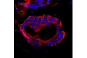 anti-Coiled-Coil and C2 Domain Containing 1A (CC2D1A) (AA 1-50) antibody