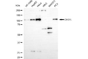Western blotting analysis using CHD1L antibody (ABIN7798067). (Recombinant CHD1L antibody)