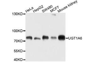 Western blot analysis of extracts of various cell lines, using UGT1A6 antibody. (UGT1A6 antibody  (AA 65-270))