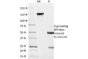 SDS-PAGE Analysis Purified Villin Mouse Monoclonal Antibody (VIL1/2376). (Villin 1 antibody  (AA 179-311))