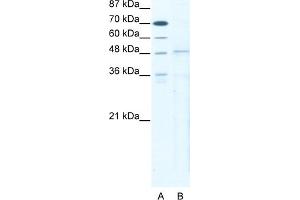 WB Suggested Anti-TBX5 Antibody   Titration: 5 ug/ml   Positive Control: HepG2 Whole Cell (T-Box 5 antibody  (N-Term))