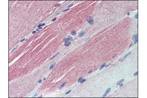 Immunohistochemistry: Human Skeletal Muscle: Formalin-Fixed, Paraffin-Embedded (FFPE). (IGFBP6 antibody  (Internal Region))