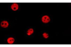 ABIN6278641 staining HepG2 by IF/ICC. (T-Box 15/18 antibody)