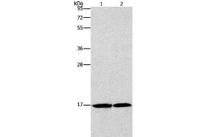 Western Blot analysis of Mouse heart and Human fetal brain tissue using GMFG Polyclonal Antibody at dilution of 1:1142 (GMFG antibody)