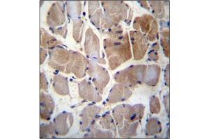 Immunohistochemistry analysis in Formalin Fixed, Paraffin Embedded Human skeletal muscle using RPS6KC1 Antibody (N-term) followed by peroxidase conjugation of the secondary antibody and DAB staining. (RPS6KC1 antibody  (N-Term))