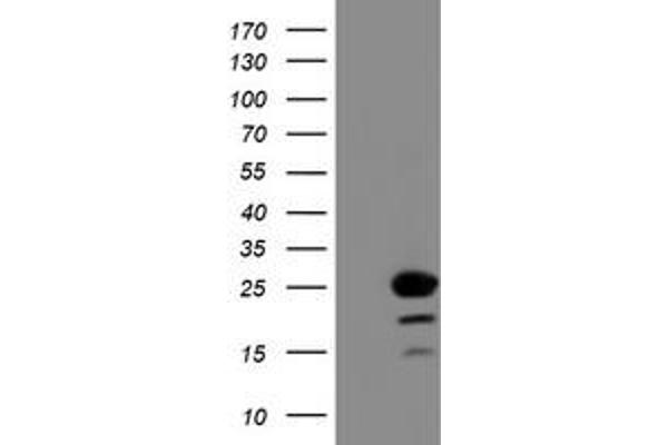 C1ORF50 antibody