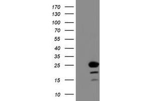 Western Blotting (WB) image for anti-Chromosome 1 Open Reading Frame 50 (C1ORF50) antibody (ABIN1497033)