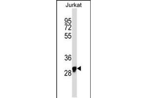 Western blot analysis in Jurkat cell line lysates (35ug/lane). (OR1N1 antibody  (C-Term))