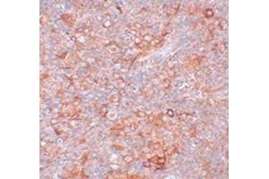 Immunohistochemical staining of mouse thymus tissue with TMEM38B polyclonal antibody  at 5 ug/mL dilution.