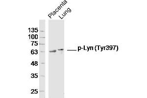 Lane 1: Mouse placenta lysates, Lane 2: Mouse lung lysates probed with Lyn (Tyr397) Polyclonal Antibody, Unconjugated  at 1:300 overnight at 4˚C. (LYN antibody  (pTyr397))