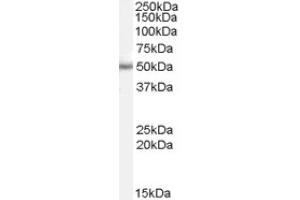 Image no. 1 for anti-Paired Box 6 (PAX6) (Internal Region) antibody (ABIN374758) (PAX6 antibody  (Internal Region))