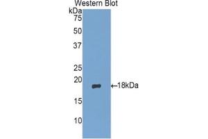 Western blot analysis of the recombinant protein. (MGP antibody  (AA 20-103))