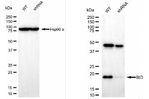 Western blotting analysis using BID antibody (ABIN7797767).