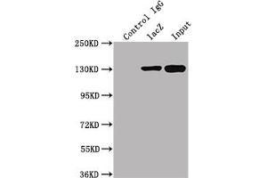 Immunoprecipitating lacZ in 293T transfected whole cell lysate   Lane 1: Mouse control IgG instead of ABIN7141389 in 293T transfected whole cell lysate. (LacZ antibody)