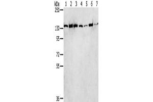 Western Blotting (WB) image for anti-SWI/SNF Related, Matrix Associated, Actin Dependent Regulator of Chromatin, Subfamily A, Member 5 (SMARCA5) antibody (ABIN2430844) (SMARCA5 antibody)