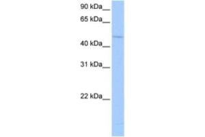 Western Blotting (WB) image for anti-RNA Binding Motif Protein 45 (RBM45) antibody (ABIN2462347) (RBM45 antibody)