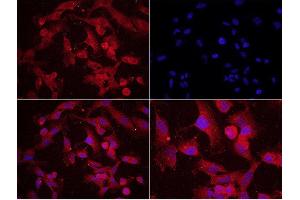 U251 cells probed with Rabbit Anti-MAP2(Ser136) Polyclonal Antibody used at 1:200 dilution for 40 minutes at 37°C. (MAP2 antibody  (pSer136))