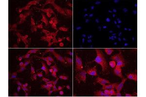 U251 cells probed with Rabbit Anti-MAP2(Ser136) Polyclonal Antibody used at 1:200 dilution for 40 minutes at 37°C. (MAP2 antibody  (pSer136))