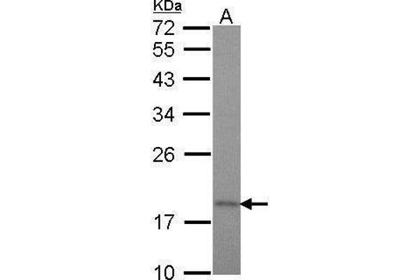 TIMM17A antibody  (C-Term)