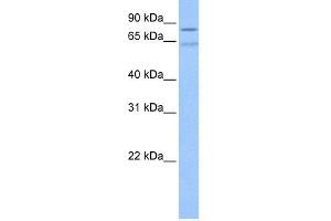 WB Suggested Anti-ZNF724P Antibody Titration:  0. (ZNF724P antibody  (N-Term))