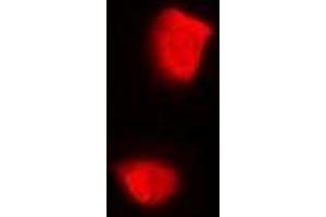Immunofluorescent analysis of PSMA2 staining in U2OS cells. (PSMA2 antibody)
