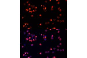 Immunofluorescence analysis of HeLa cells using  antibody (ABIN3020944, ABIN3020945, ABIN3020946 and ABIN6213811) at dilution of 1:100. (AKT2 antibody)