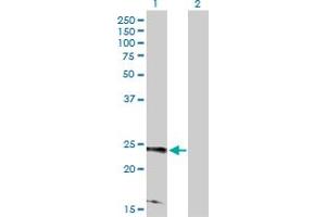 Western Blot analysis of RRAS2 expression in transfected 293T cell line by RRAS2 MaxPab polyclonal antibody. (RRAS2 antibody  (AA 1-204))