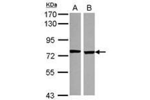 Image no. 1 for anti-Sodium Channel, Nonvoltage-Gated 1, delta (SCNN1D) (Internal Region) antibody (ABIN1496146)