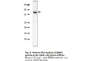 Western Blotting (WB) image for anti-Ribonucleotide Reductase M2 (RRM2) (C-Term) antibody (ABIN2452118) (RRM2 antibody  (C-Term))