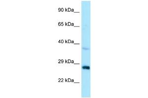 WB Suggested Anti-CTDSP1 Antibody Titration: 1. (CTDSP1 antibody  (N-Term))