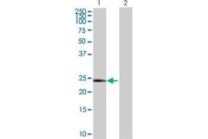 Western Blot analysis of RNF135 expression in transfected 293T cell line by RNF135 MaxPab polyclonal antibody.