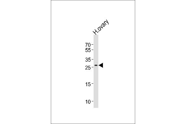 LRRN4CL antibody  (AA 117-146)