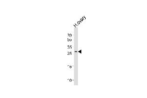 Western blot analysis of lysate from human ovary tissue lysate, using LRRN4CL Antibody (Center) (ABIN656629 and ABIN2845875).
