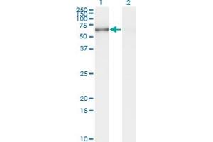 Western Blot analysis of STK33 expression in transfected 293T cell line by STK33 monoclonal antibody (M09), clone 1F10. (STK33 antibody  (AA 1-514))