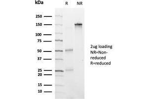 SDS-PAGE Analysis Purified HDAC6 Mouse Monoclonal Antibody (PCRP-HDAC6-1A4).