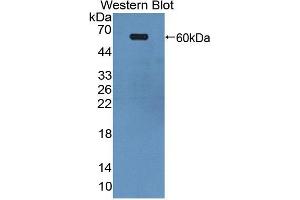 Western blot analysis of the recombinant protein. (EPH Receptor A4 antibody  (AA 621-882))