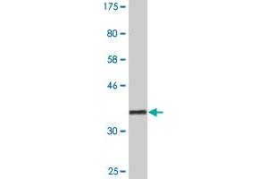 Western Blot detection against Immunogen (36. (RSU1 antibody  (AA 178-277))