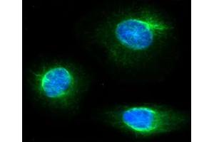 ICC/IF analysis of FKBP4 in HeLa cells line, stained with DAPI (Blue) for nucleus staining and monoclonal anti-human FKBP4 antibody (1:100) with goat anti-mouse IgG-Alexa fluor 488 conjugate (Green). (FKBP4 antibody  (AA 1-459))